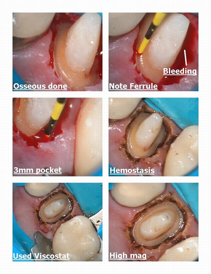 DM osseous pg 3.jpg